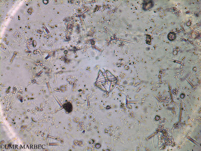 phyto/Brazilian_Amazon_coast/Amazomix_station_18/AMAZOMIX September 2021/Protoperidinium cf vulgare (Am_ST18_surf_proto_cf_conicum240902_005)(copy)_thumb.jpg